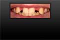 Yo mama has so many teeth missing, it looks like her tongue is in jail.